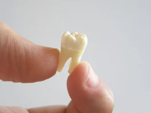 person's thumb and index finger holding extracted molar tooth, tooth extractions Rocky River dentist