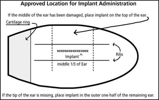 Implants - ear