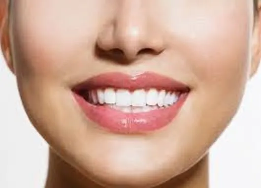 Teeth Whitening