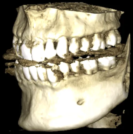 CBCT 2