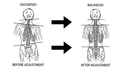 spinalscan.jpg