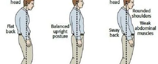 CUPERTINO Chiropractor | CUPERTINO chiropractic Posture | CA |