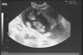 ultrasound3.jpg