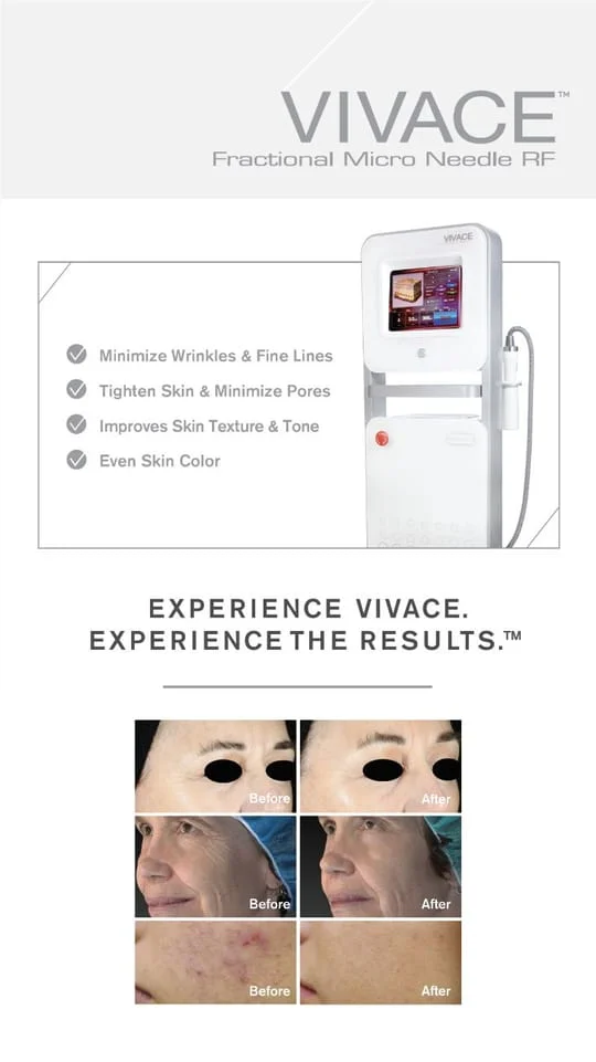 Vivace Radiofrequency Microneedling