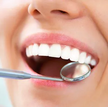 dental mirror in woman's open mouth reflecting white filling under top tooth, dental fillings Roslyn, NY dentist