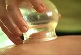 CUPPING.jpg