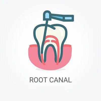 root canal stafford va