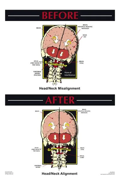 Adjustment_2.jpg