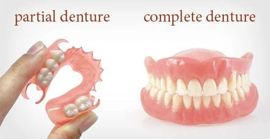 Dentures are a replacement for missing teeth that can be removed and put back into your mouth as you please. Depending on each individual patient case, they may receive full or partial dentures. Full dentures are used when all of the natural teeth are removed from the mouth and replaced with a full set of dentures. There are two types of full dentures.  Conventional Full Dentures - This is when all the teeth are removed and the tissue is given time to heal before the dentures are placed. It could take a few months for the gum tissue to heal completely, and during this time you will be without teeth. Immediate Full Dentures - Prior to having your teeth removed, your dentist takes measurements and has dentures fitted for your mouth. After removing the teeth, the dentures are immediately placed in your mouth. The benefit is that you do not have to spend any time without teeth. You will, however, need to have a follow up visit to refit your dentures because the jaw bone will slightly change shape as your mouth heels. The dentures will need to be tightened after the jaw bone has healed. Partial dentures are another option when not all of your teeth need to be removed. This is similar to a bridge, but it is not a permanent fixture in your mouth.  Your dentures may take some time to get used to. The flesh colored base of the dentures is placed over your gums. Some people say that it feels bulky or that they don't have enough room for their tongue. Other times the dentures might feel loose. These feelings will affect the way you eat and talk for a little while. Over time, your mouth becomes trained to eat and speak with your dentures and they begin to feel more and more like your natural teeth. They may never feel perfectly comfortable, but it is much better than the alternative of not having teeth.  Even though dentures are not real teeth, you should care for them like they are. You should brush them to remove plaque and food particles before removing your dentures. After they have been removed you should place them directly into room temperature water or a denture cleaning solution. Never use hot water because it could warp the dentures. Your dentures are delicate, so make sure you are careful when handling them so you don't drop them. Also, never try to adjust your dentures yourself. You could ruin them, so you should always seek assistance from your dentist if they feel uncomfortable or loose.