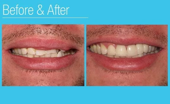 Before and after photos Dentist Milwaukee WI