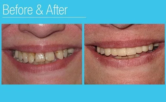 Milwaukee WI Dentist before and after