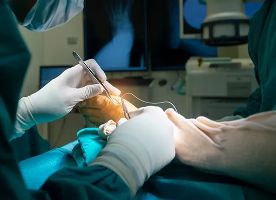 Foot-and-Ankle-Surgery-in-Fort-Dodge-IA