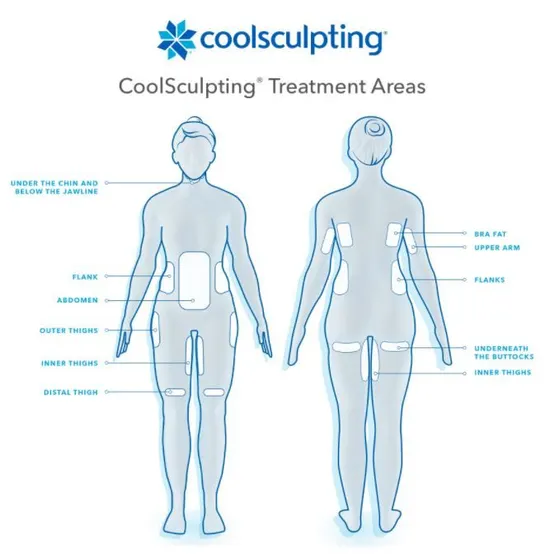 CoolSculpting vs. RF Body Contouring - The Laser Cafe