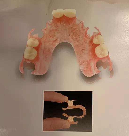 Dentures in Reston, VA