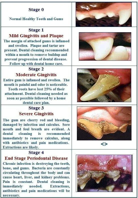 Dental Chart