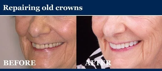 repairing old crowns - before and after