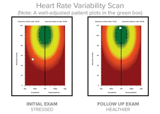 HRV