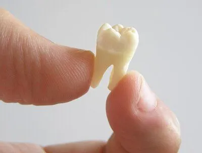 person's thumb and forefinger holding extracted molar tooth, dentist Lincoln, NE tooth extraction