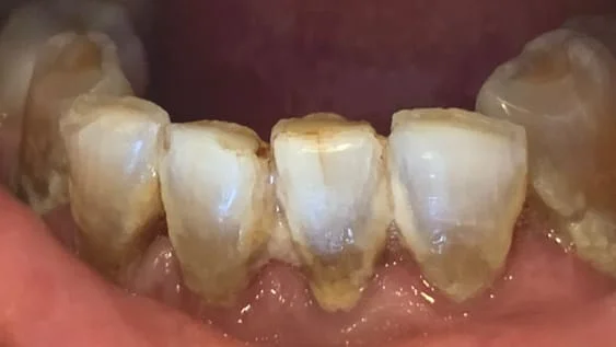 Periodontal | Dentist in Reston, VA