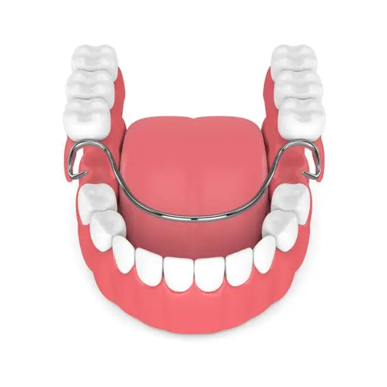 illustration of bottom partial dentures being placed in mouth, partial dentures Melrose dentist