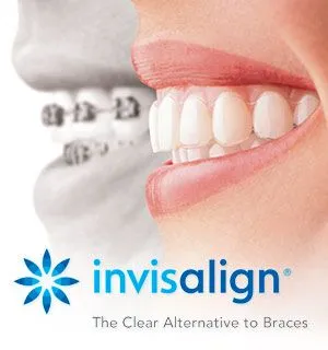 mouth with braces next to mouth with Invisalign clear aligners, logo for Invisalign at bottom, Invisalign Peachtree City, GA dentist