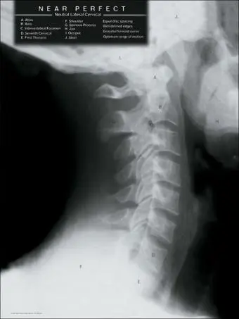 cervical x-ray