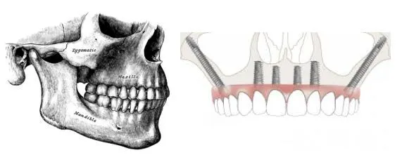 Zygoma