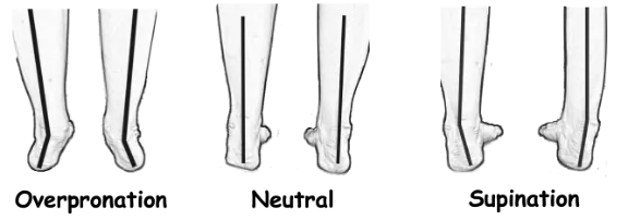 foot over to under pronation
