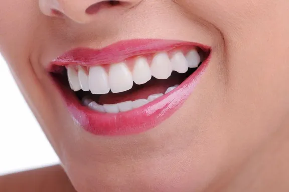 Cosmetic Dentistry Gothenburg