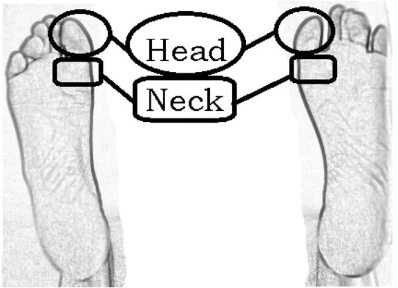 Figure 7‑11: Pressure points to relieve headaches found in the foot