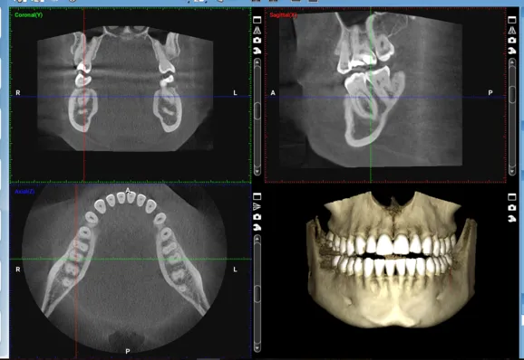 cbct-technology-general-dentist-in-pittsburgh-pa-the-dentists-at-mercy