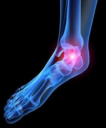 Cicero Podiatrist | Cicero Heel Pain/Fasciitis | IL | Luis E Mendoza, DPM |