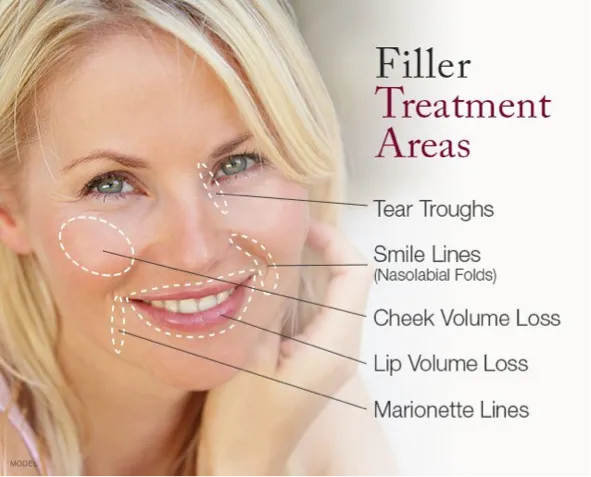 Filler Treatments 