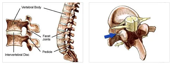 facet-joint-combo