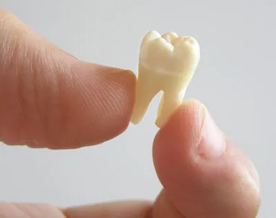 thumb and index finger holding extracted molar tooth, tooth extractions North York, ON dentist
