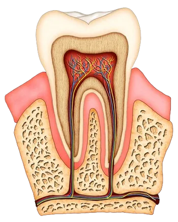 colored illustration of interior of molar tooth showing roots, tissue, nerves and root canal Bradenton, FL dentist