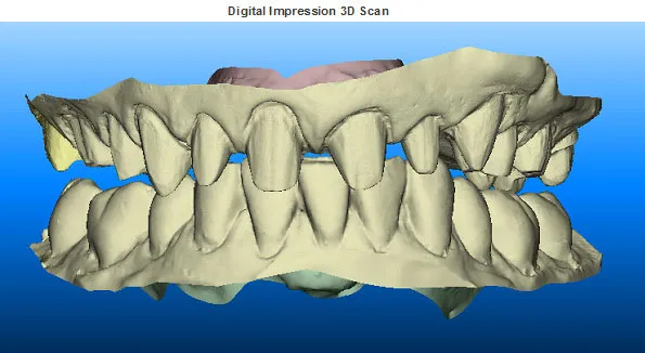 3D Scan