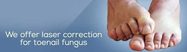 laser correction for toenail fungus