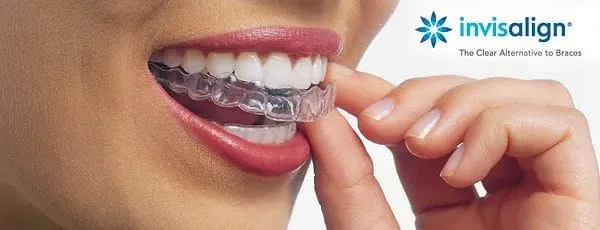 Invisalign®