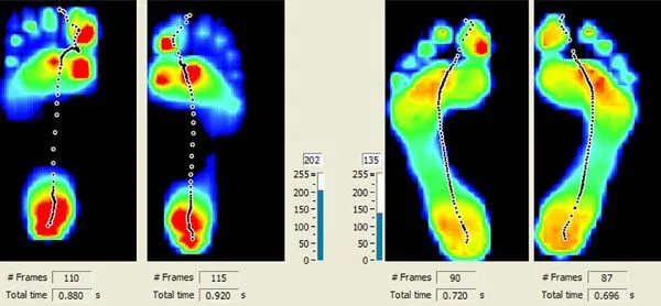 Gait Scan Comparison Screen.