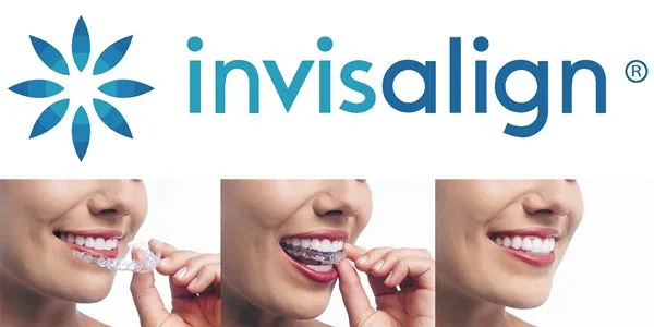 Invisalign