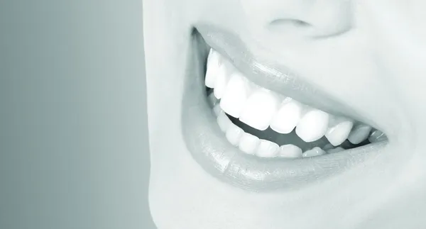 Dental Implants Salt Lake City