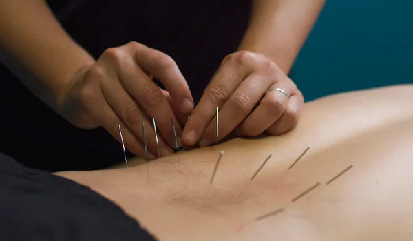 Cold Laser Therapy & Trigger Point Dry Needling