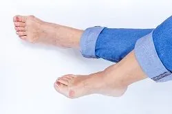 Bunion Surgery Tyler, TX