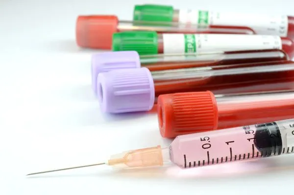 test tubes with blood and serum