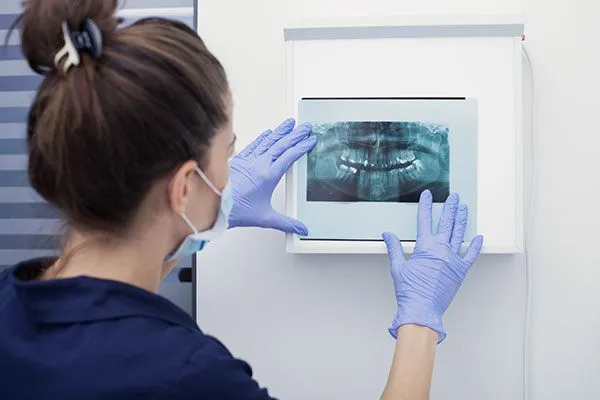 dental staff and dental xray