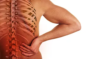 Disc Herniation San Antonio, TX