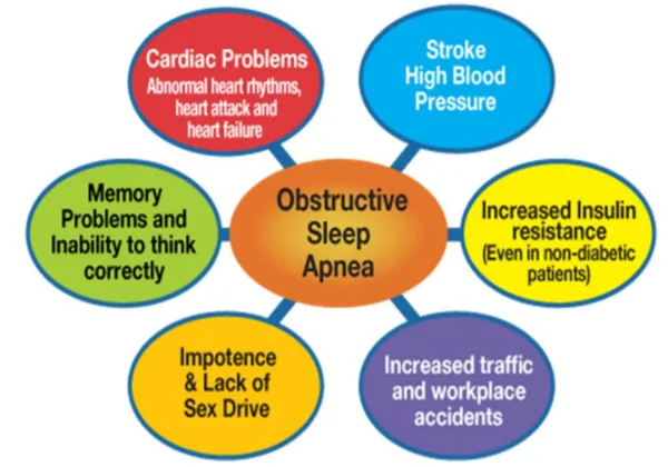 Sleep Apnea