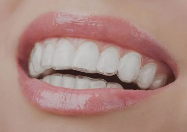 Teeth Whitening