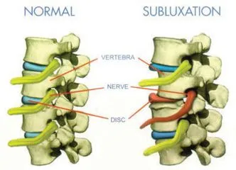 Chiropractic Adjustmen